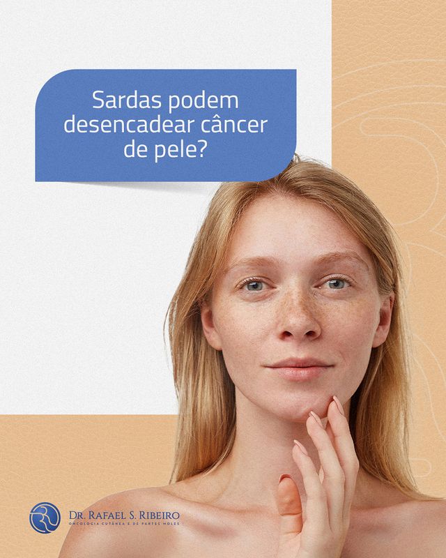 Sardas podem desencadear câncer de pele?