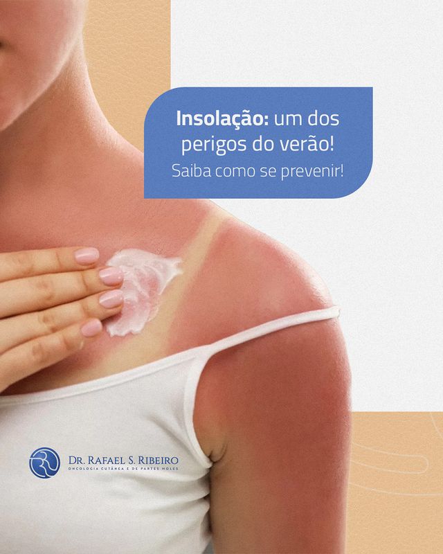 Insolação: um dos perigos do verão! Saiba como se prevenir!