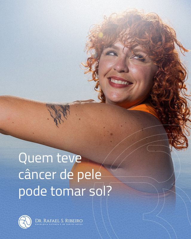 Quem teve câncer de pele pode tomar sol?
