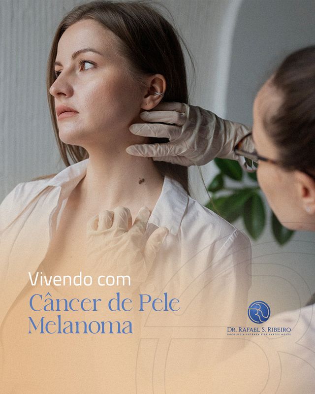 Vivendo com câncer de pele melanoma